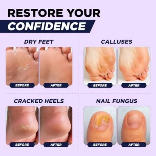 FOOT CURE Soothing Lavender Epsom Salt Foot Soak 473ml (16 Fl Oz) | Night Time Relaxation thumbnail 5