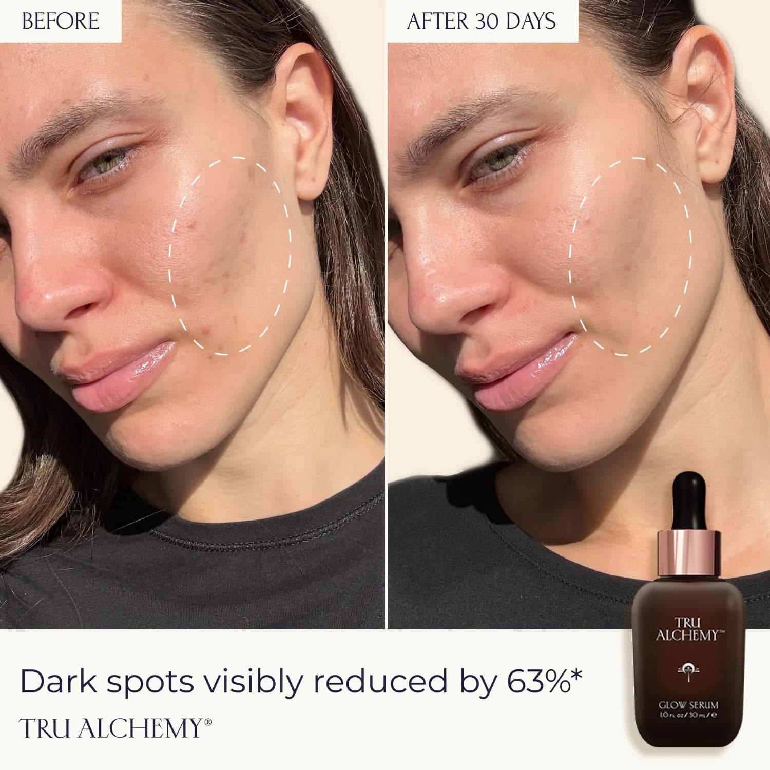 Tru Alchemy Vitamin C Glow Serum 29.57ml (1 fl oz) | Hydrating Anti-Aging Face Serum with Bakuchiol & Acids - view 2