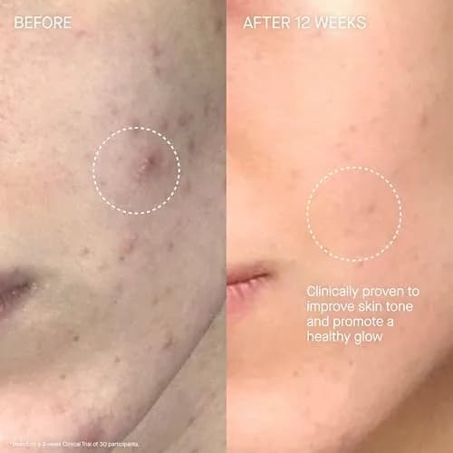 Augustinus Bader The Cream – Luxury Face Moisturizer 50ml | Hydrating & Nourishing for Wrinkle Reduction thumbnail 5