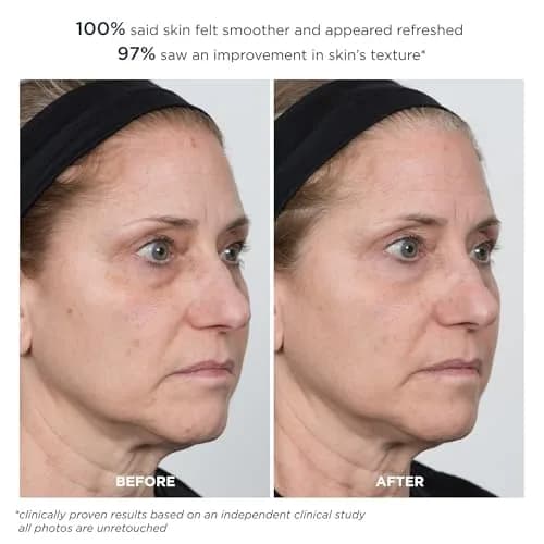 m-61 PowerGlow Peel Extra Strength 20% | Overnight Skin Resurfacing Treatment thumbnail 6