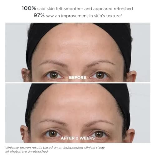 m-61 PowerGlow Peel Extra Strength 20% | Overnight Skin Resurfacing Treatment thumbnail 7