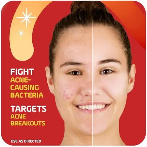 Asepxia 2% Salicylic Acid Acne Spot Treatment Cream | Targets Blemishes & Redness, 1 Oz, 3-Pack thumbnail 4
