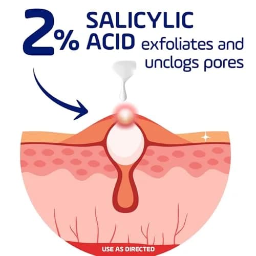 Asepxia 2% Salicylic Acid Acne Spot Treatment Cream | Targets Blemishes & Redness, 1 Oz, 3-Pack thumbnail 5