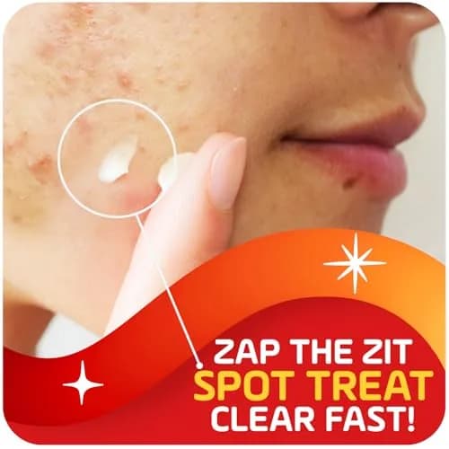 Asepxia 2% Salicylic Acid Acne Spot Treatment Cream | Targets Blemishes & Redness, 1 Oz, 3-Pack thumbnail 2