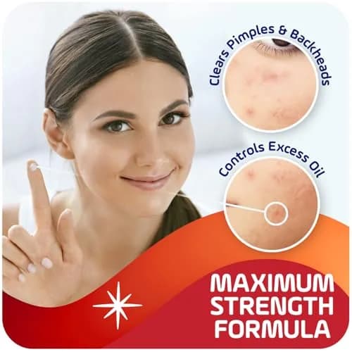 Asepxia 2% Salicylic Acid Acne Spot Treatment Cream | Targets Blemishes & Redness, 1 Oz, 3-Pack thumbnail 3