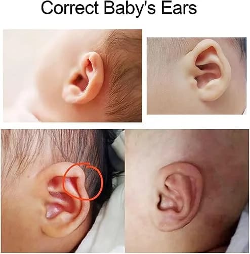 Brrnoo Auricle Correction Patch 50cm x 4cm (1.97in x 1.6in) | Corrects Protruding Ears for Infants thumbnail 7