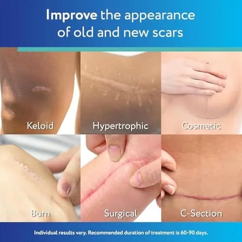 ScarAway Advanced Clear Silicone Scar Sheets, 6 Sheets | Visibly Improve Old & New Scars thumbnail 2
