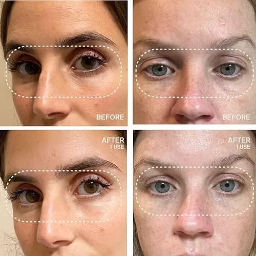 Dermaclara Eye & Mouth Patches | Reusable Silicone Anti-Wrinkle Pads for Smile Lines & Under Eye, 4 Count thumbnail 5