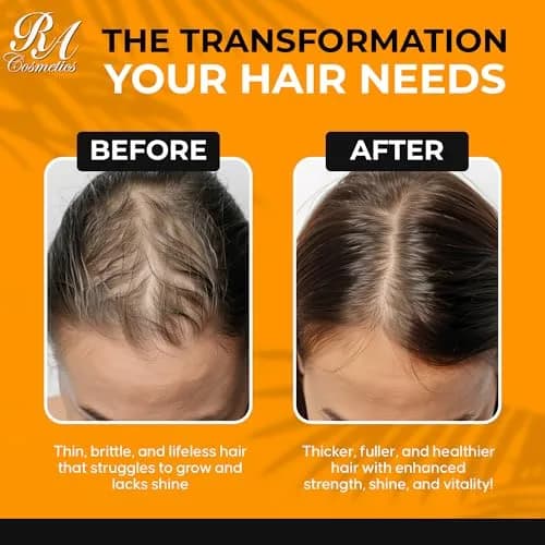 RA COSMETICS Batana Hair Oil 16 oz | Natural, Unrefined, Moisturizing & Strengthening Hair Oil for All Hair Types thumbnail 9