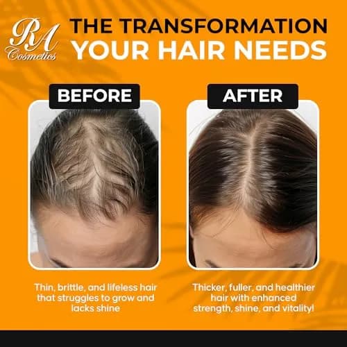 RA COSMETICS Unrefined Batana Hair Oil 8 oz | Natural Growth & Repair for Damaged Hair thumbnail 9