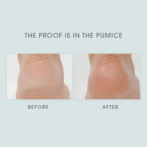 LATHER Vegan Skin Exfoliant 8 oz | Natural Foot & Body Scrub for Cracked Heels & Calluses thumbnail 5