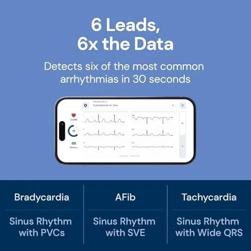 KardiaMobile 6L Max EKG Monitor with 1-Year KardiaCare | FDA-Cleared, Medical-Grade Heart Monitor, 30-Second Results, Unlimited Recordings thumbnail 3