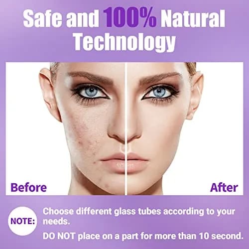 UUPAS High Frequency Facial Wand with 4 Violet Glass Electrodes | Portable Handheld Skin Therapy Device thumbnail 5
