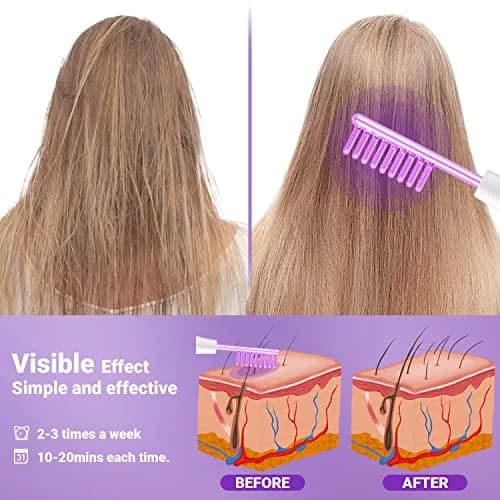 UUPAS High Frequency Facial Wand with 4 Violet Glass Electrodes | Portable Handheld Skin Therapy Device thumbnail 6