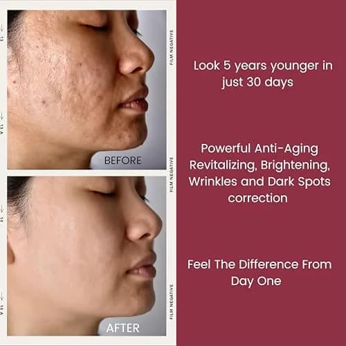 TURBINNE Pure 2.5% Retinol Serum Capsules (30 Count) | Look 5 Years Younger in 30 Days with Deep Hydration thumbnail 9