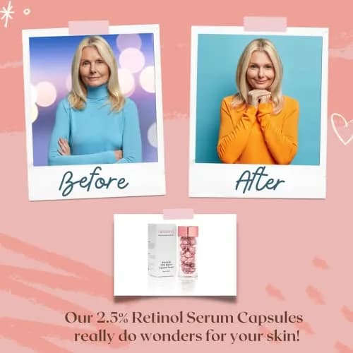 TURBINNE Pure 2.5% Retinol Serum Capsules (30 Count) | Look 5 Years Younger in 30 Days with Deep Hydration thumbnail 2