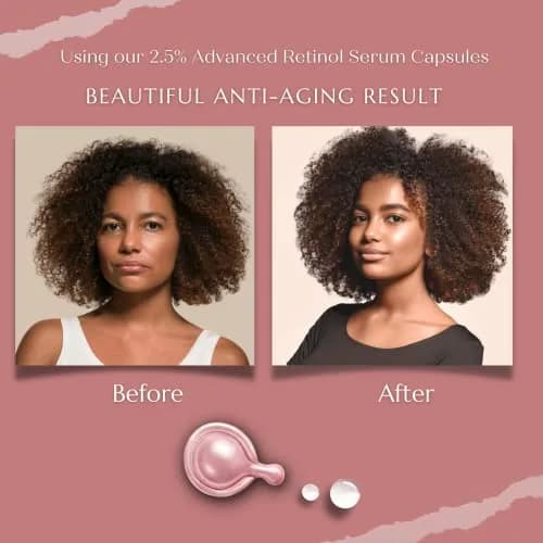 TURBINNE Pure 2.5% Retinol Serum Capsules (30 Count) | Look 5 Years Younger in 30 Days with Deep Hydration thumbnail 3