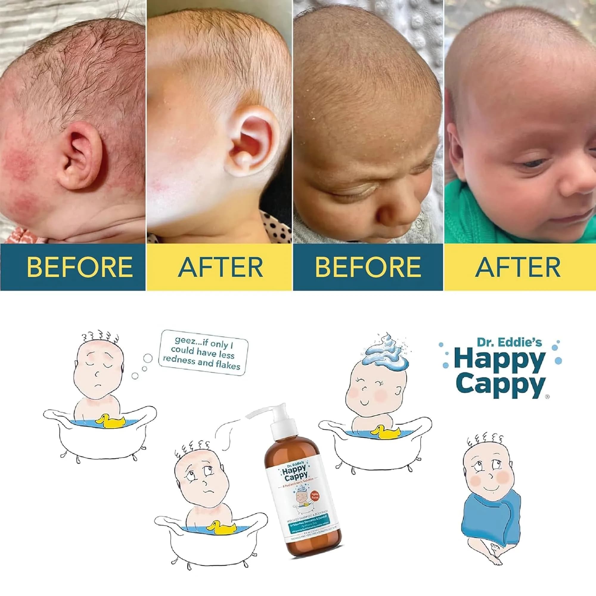 Happy Cappy Medicated Shampoo and Body Wash 32 Fl Oz (Pack of 4) | Pediatrician-Designed for Cradle Cap & Dandruff - view 6