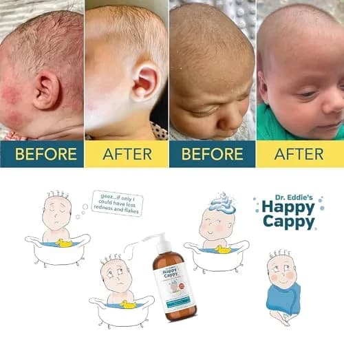 Happy Cappy Medicated Shampoo and Body Wash 32 Fl Oz (Pack of 4) | Pediatrician-Designed for Cradle Cap & Dandruff thumbnail 6