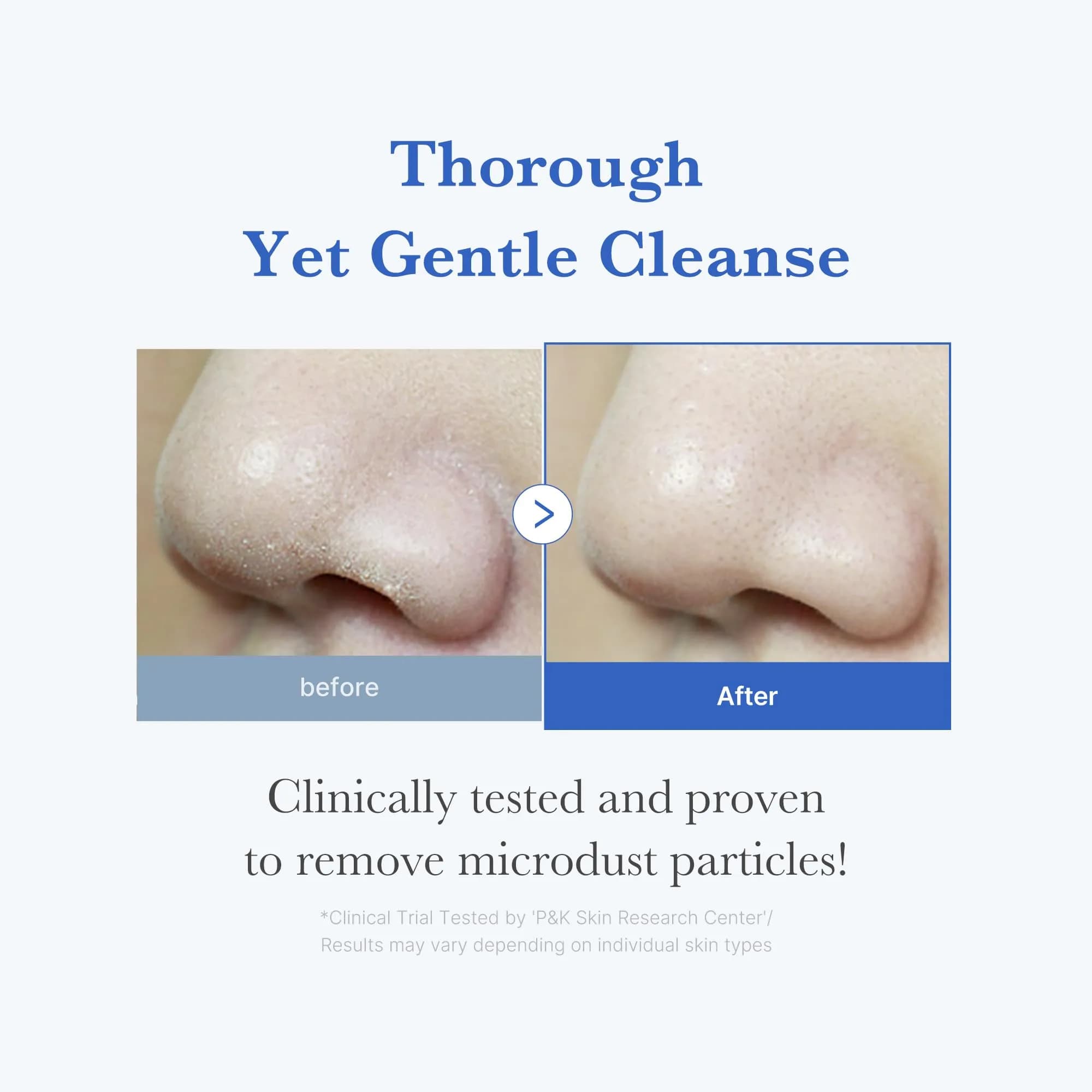 medicube Zero Foam Cleanser (120ml) | Gentle Daily Facial Cleansing Foam for Sensitive Skin - view 3