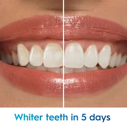 Crest 3D White Advanced Luminous Mint Toothpaste 105ml (3.7 oz) | Removes 90% More Stains thumbnail 3