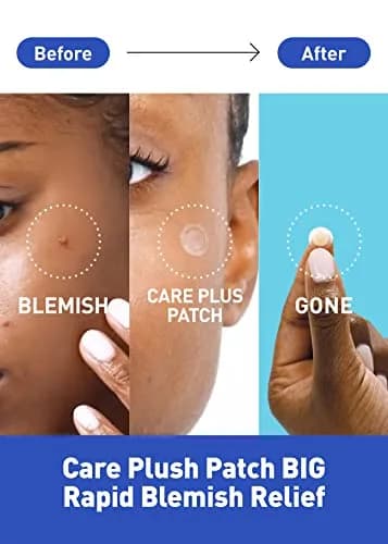 OLIVE YOUNG Hydrocolloid Spot Patch Big 81 Count | Acne & Pimple Treatment for All Skin Types thumbnail 2