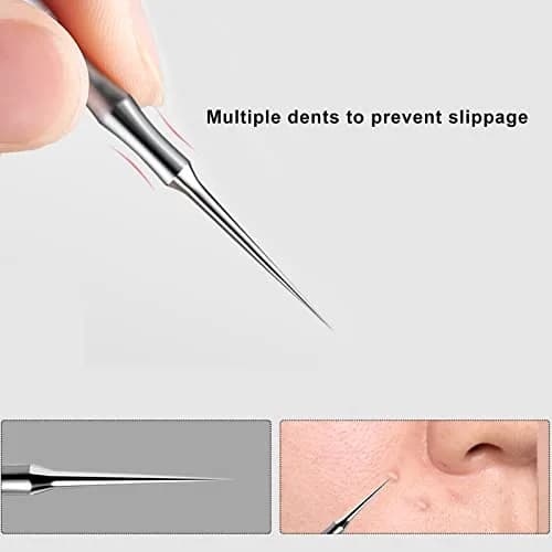 jaxiria Skin Care Tool - Stainless Steel Blemish Remover for Face & Nose | 1 Count thumbnail 4