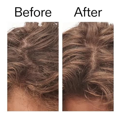 The INKEY List Glycolic Acid Exfoliating Scalp Scrub 150ml (5.07 fl oz) | Promotes Healthy Hair Growth & Balances Scalp Oil thumbnail 6