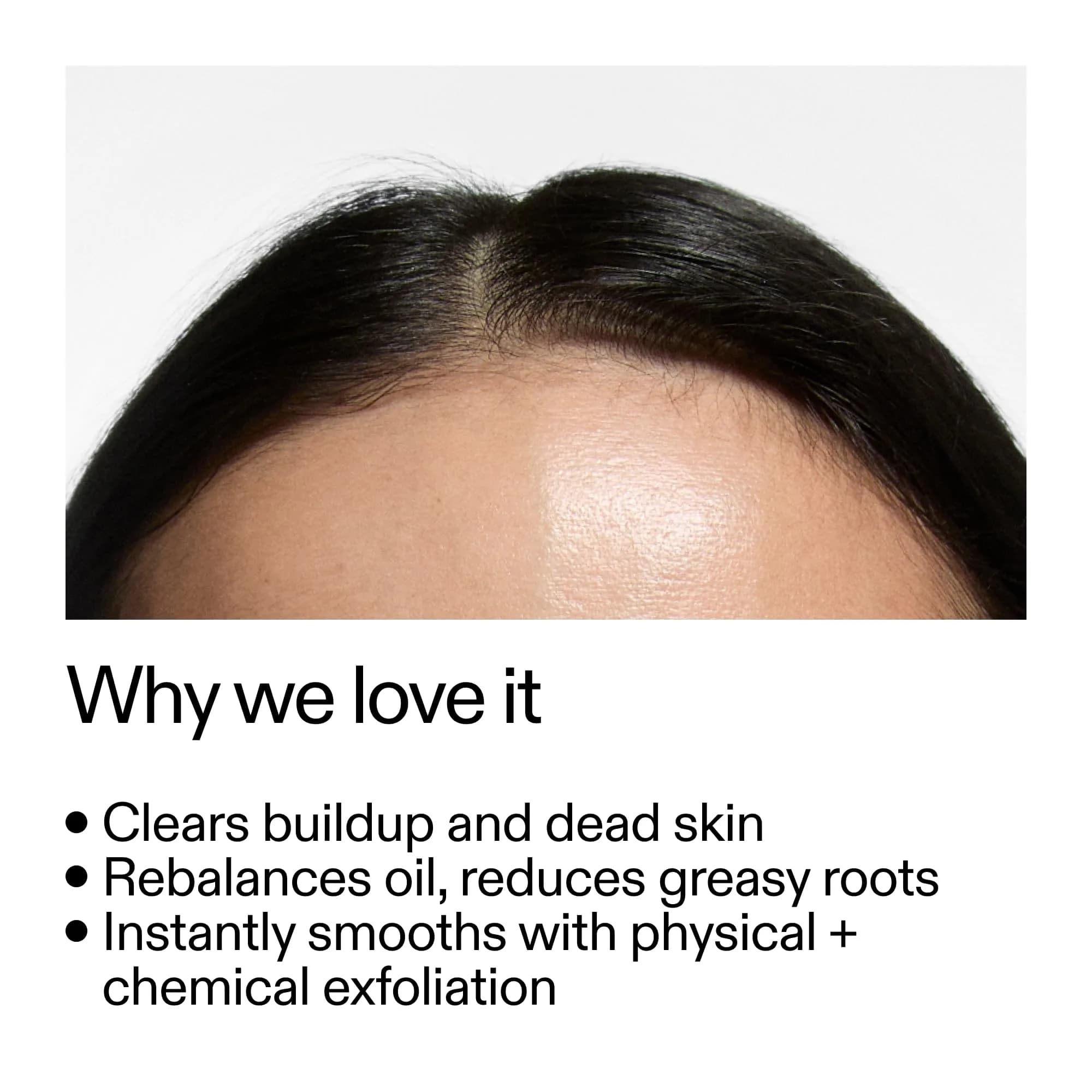 The INKEY List Glycolic Acid Exfoliating Scalp Scrub 150ml (5.07 fl oz) | Promotes Healthy Hair Growth & Balances Scalp Oil - view 2
