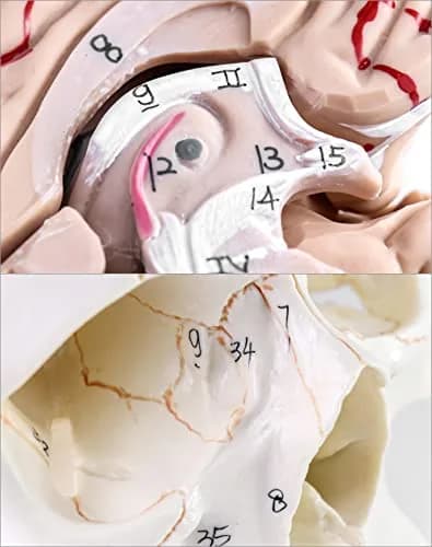 QWORK Human Skull and Brain Anatomy Model, 11 Parts, Life Size, Numbered, Anatomically Accurate, PVC (1.58 kg / 3.48 lb) thumbnail 6