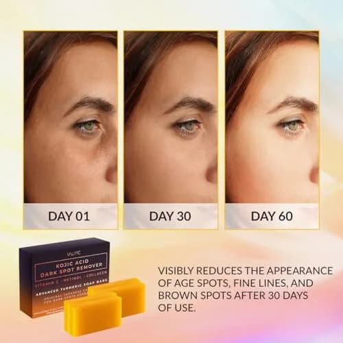 VALITIC Kojic Acid Dark Spot Remover Soap Bars 100g (3.52oz) 4-Pack | Japanese Complex for Even Tone & Glow thumbnail 2