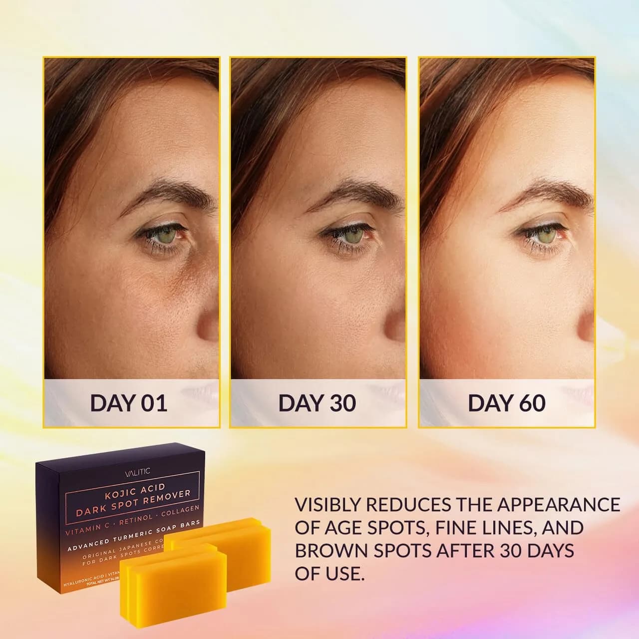 VALITIC Kojic Acid Dark Spot Remover Soap Bar 4 Pack (14 oz / 397 g) | Original Japanese Complex for Even Skin Tone - view 2