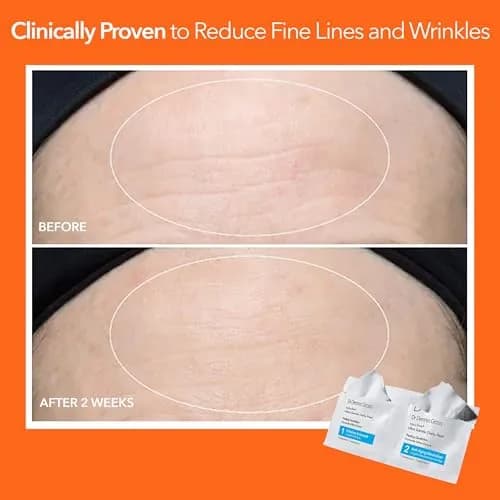 Dr Dennis Gross Alpha Beta Ultra Gentle Exfoliating Daily Peel - 5 Pack | Dermatologist-Formulated for Sensitive Skin thumbnail 6