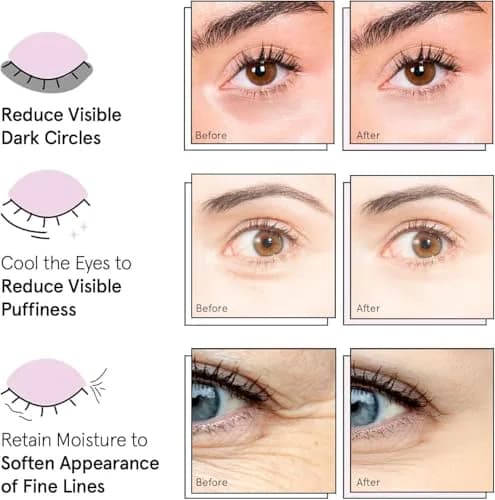 grace & stella Under Eye Mask 72 Pairs (Gold, Pink, & Blue) | Reduces Dark Circles, Puffiness, Wrinkles thumbnail 7