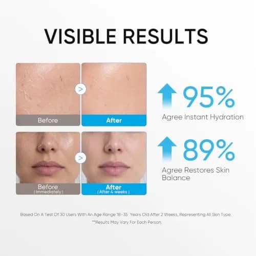 SKINTIFIC 5X Ceramide Barrier Repair Moisturizer for Sensitive Skin | Hydrates & Strengthens Skin Barrier thumbnail 4