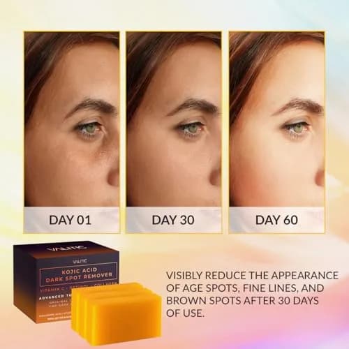 VALITIC Kojic Acid Dark Spot Remover Soap Bars 3 Pack | Japanese Complex for Even Tone & Healthy Glow thumbnail 2
