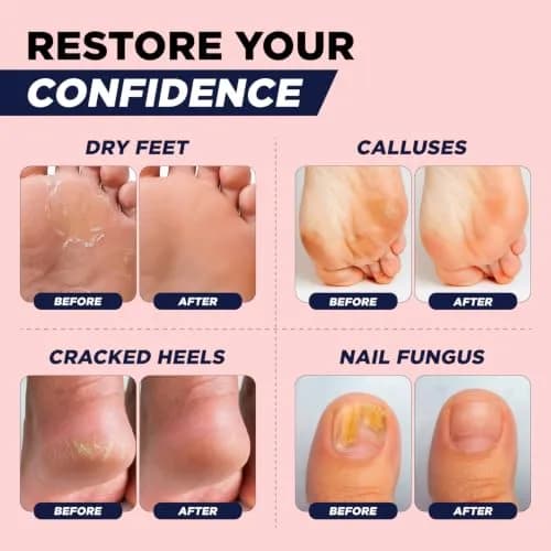 FOOT CURE Muscle Recovery Foot Soak with Epsom Salt, Post Workout, Deep Relaxation - 946ml (32 Fl Oz) | Natural Ingredients for Tired Feet thumbnail 5