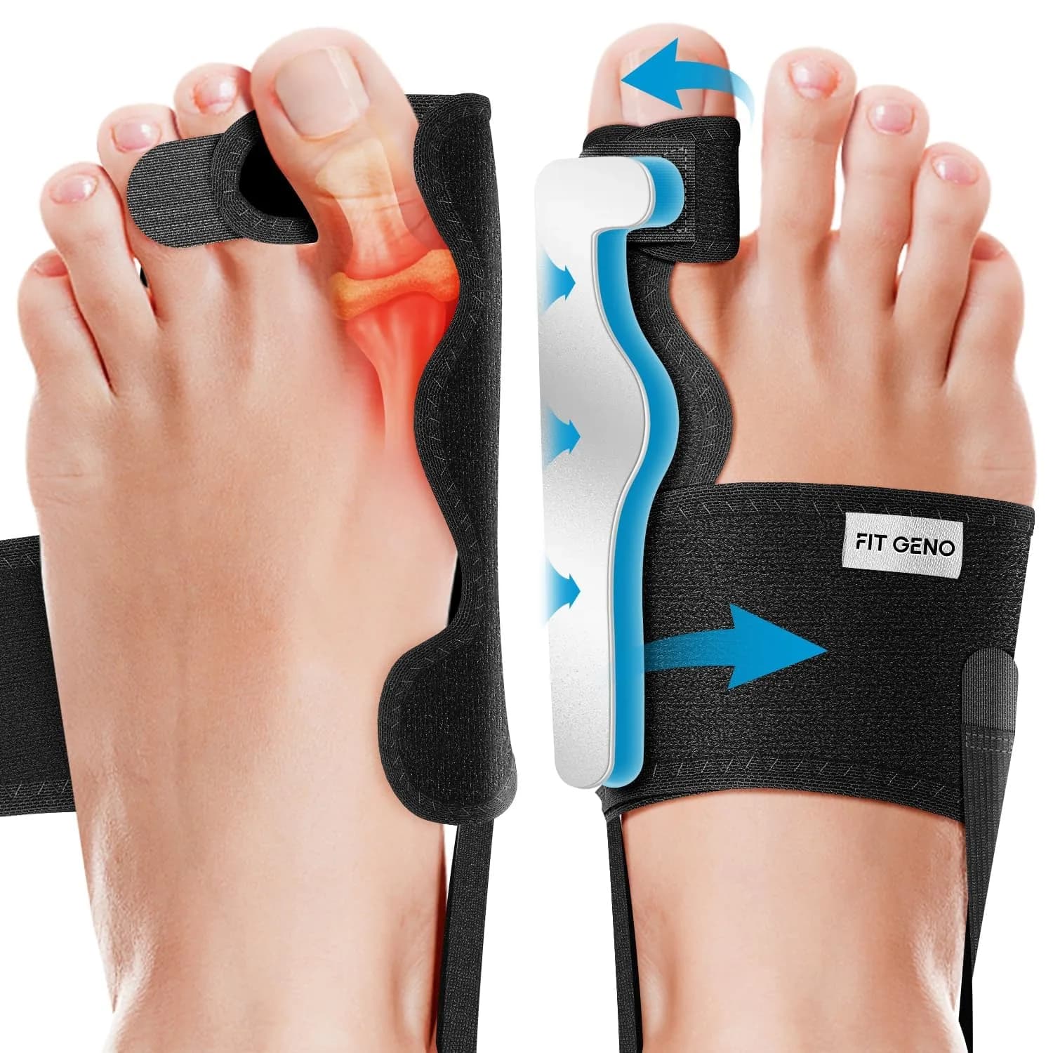 Fit Geno Bunion Corrector Women & Men Big Toe | Adjustable Orthopedic Support for Hallux Valgus — Black