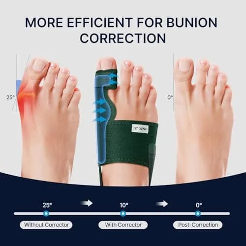 Fit Geno Bunion Corrector Women & Men Big Toe | Adjustable Orthopedic Support for Hallux Valgus thumbnail 2