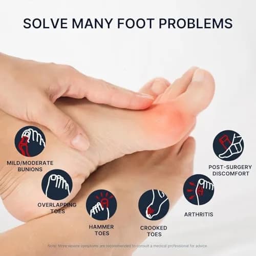 Fit Geno Bunion Corrector Women & Men Big Toe | Adjustable Orthopedic Support for Hallux Valgus thumbnail 3