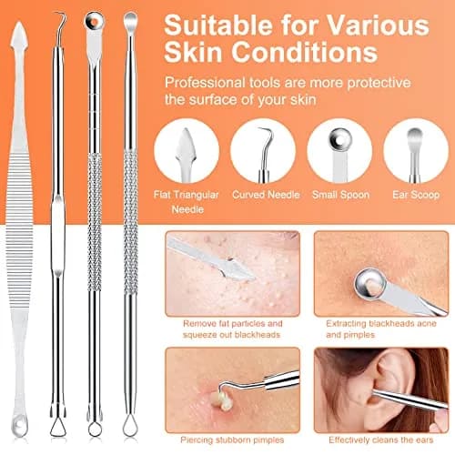 IUMAKEVP Black 15 PCS Skin Blemish Removal Tool Kit | Professional Stainless Steel Acne & Pimple Extractor (Silver) thumbnail 3