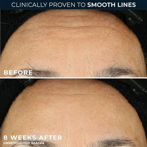 RoC Retinol Correxion Night Serum Capsules 80 CT | Anti-Aging & Wrinkle Reduction thumbnail 4