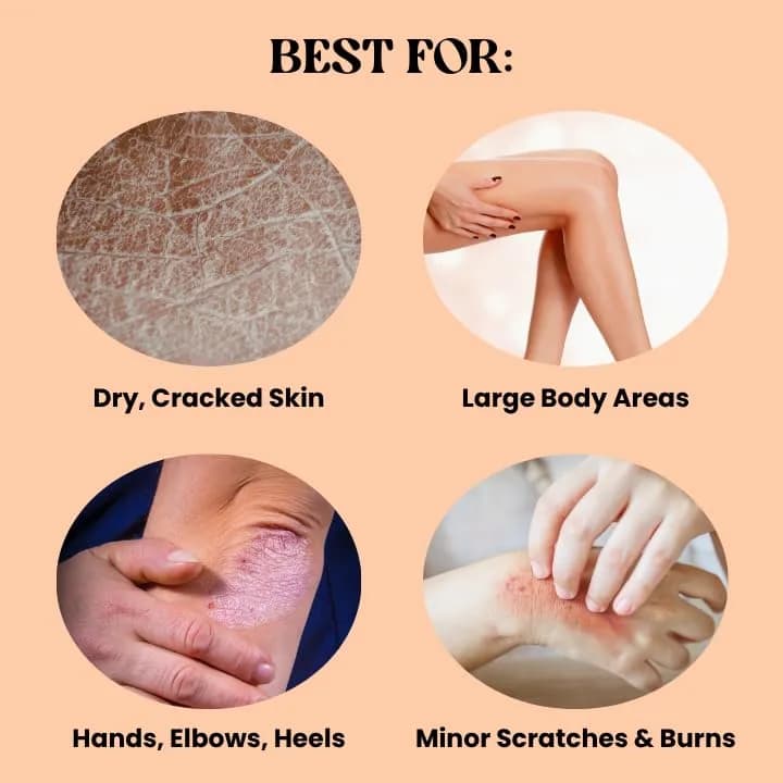 Yu-Be Body Lotion for Dry, Sensitive Skin | Non-Greasy, Fast-Absorbing Moisturizer 10.25 fl oz (3-Pack) thumbnail 13