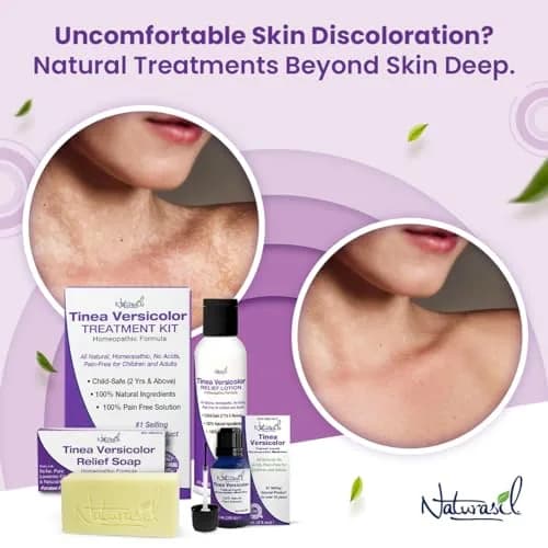 Naturasil Tinea Versicolor Treatment Lotion for Uneven Skin Tone | Fast-Acting Homeopathic 4 oz thumbnail 7