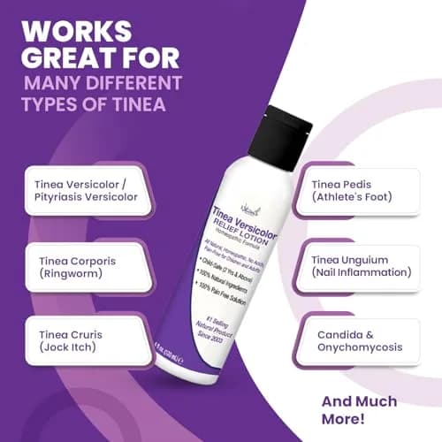 Naturasil Tinea Versicolor Treatment Lotion for Uneven Skin Tone | Fast-Acting Homeopathic 4 oz thumbnail 3