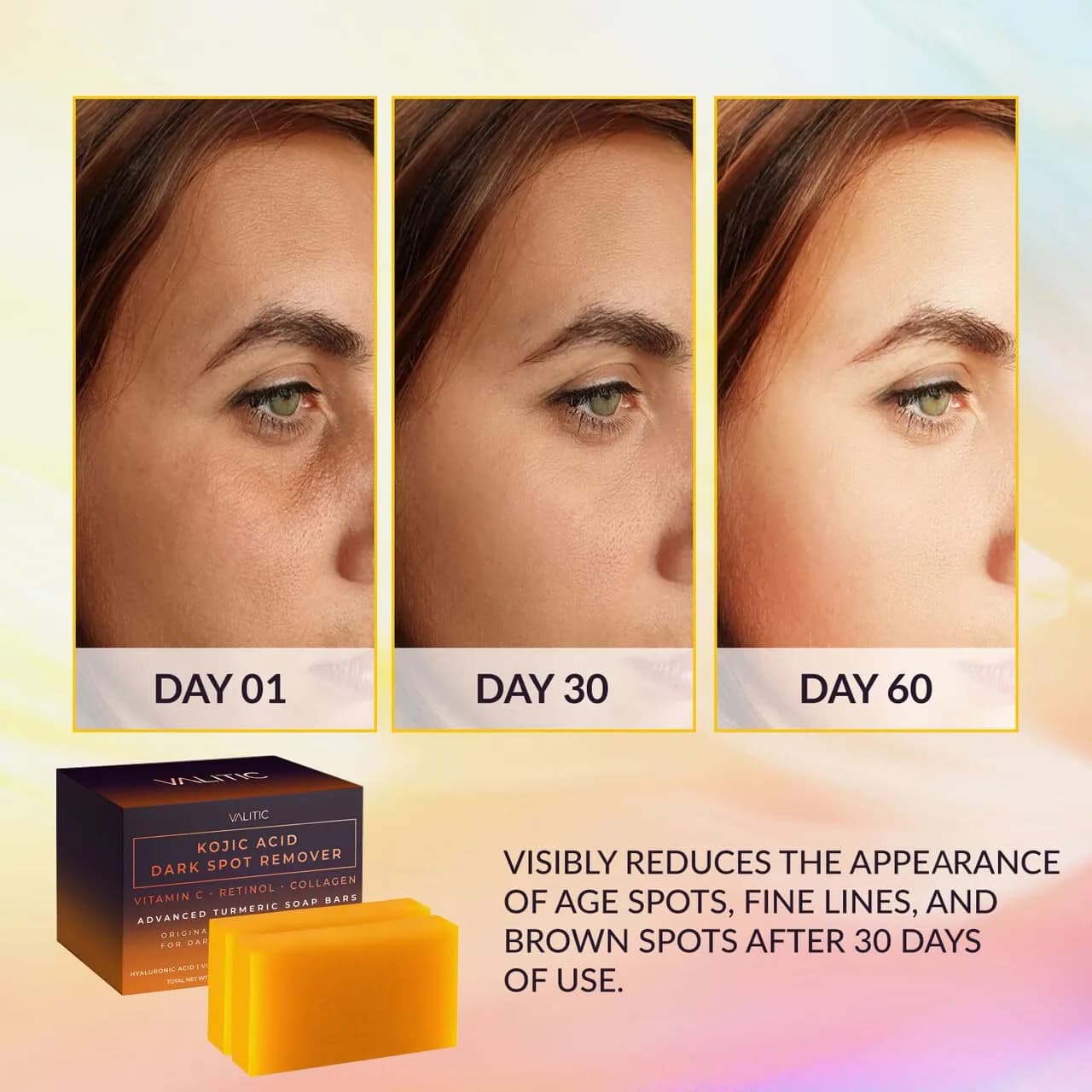 VALITIC Kojic Acid Soap Bars 200g (7 Oz) 2 Pack with Soap Holder for Even Tone - view 2