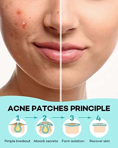 TKTK Acne Patch Hydrocolloid Cover 4 Sizes | Tea Tree & Calendula for All Skin Types thumbnail 6