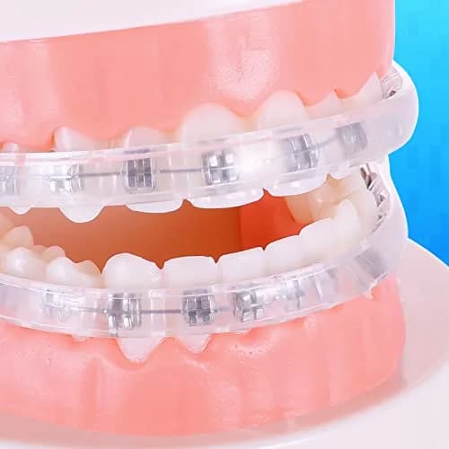 Obrush Comfort Covers for Braces | Orthodontic Mouth Guard & Lip Protector, Clear, 4.2"/3.9" thumbnail 5