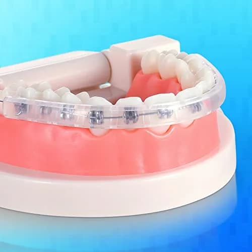 Obrush Comfort Covers for Braces | Orthodontic Mouth Guard & Lip Protector, Clear, 4.2"/3.9" thumbnail 6