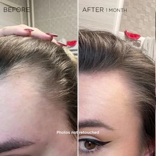 PHYTO Women Revitalizing Hair Serum 12 Vials | Supports Reactional Hair Thinning, Stress & Postpartum Recovery thumbnail 3